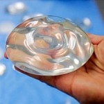 Breast implant removal