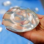 Breast Implant Removal